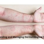 Understanding and Managing Dermatological Problems: Causes, Symptoms, and Treatments